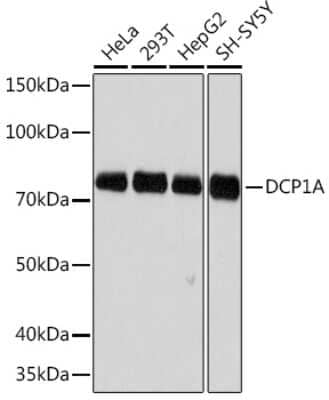 Western Blot: Dcp1a Antibody (7Q8Q6) [NBP3-16644] - Western blot analysis of extracts of various cell lines, using Dcp1a Rabbit mAb (NBP3-16644) at 1:500 dilution. Secondary antibody: HRP Goat Anti-Rabbit IgG (H+L) at 1:10000 dilution. Lysates/proteins: 25ug per lane. Blocking buffer: 3% nonfat dry milk in TBST. Detection: ECL Basic Kit. Exposure time: 3min.