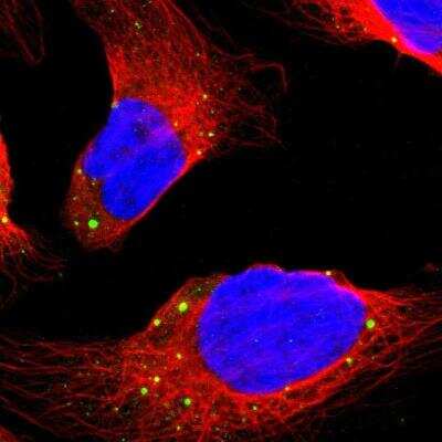 Immunocytochemistry/Immunofluorescence: Dcp1a Antibody [NBP2-59785] - Human cell line U-2 OS shows localization to cytoplasmic bodies. Antibody staining is shown in green.