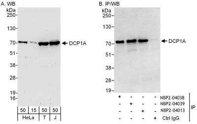 Immunoprecipitation: Dcp1a Antibody [NBP2-04013] - Samples:  Whole cell lysate from HeLa (15 and 50 ug for WB; 1 mg for IP, 20% of IP loaded), 293T (T; 50 ug) and Jurkat (J; 50 ug) cells.  Antibodies: Affinity purified rabbit anti-DCP1A antibody NBP2-04013 used for WB at 0.4 ug/ml (A) and 1 ug/ml (B) and used for IP at 6 ug/mg lysate.  DCP1A was also immunoprecipitated by rabbit anti-DCP1A antibodies NBP2-04038 and NBP2-04039, which recognize upstream epitopes.   Detection: Chemiluminescence with exposure times of 3 minutes (A) and 10 seconds (B).