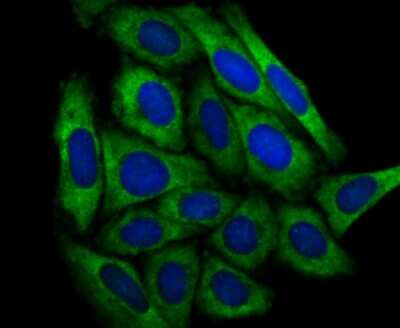 Immunocytochemistry/Immunofluorescence: Dcp1a Antibody (JB51-34) [NBP2-75463] - Staining Dcp1a in SiHa cells (green). The nuclear counter stain is DAPI (blue). Cells were fixed in paraformaldehyde, permeabilised with 0.25% Triton X100/PBS.