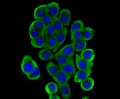 Immunocytochemistry/Immunofluorescence: Dcp1a Antibody (JB51-34) [NBP2-75463] - Staining Dcp1a in LOVO cells (green). The nuclear counter stain is DAPI (blue). Cells were fixed in paraformaldehyde, permeabilised with 0.25% Triton X100/PBS.