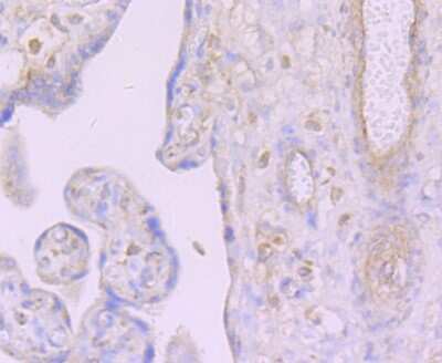 Immunohistochemistry-Paraffin: Dcp1a Antibody (JB51-34) [NBP2-75463] - Analysis of paraffin-embedded human placenta tissue using anti-Dcp1a antibody. Counter stained with hematoxylin.