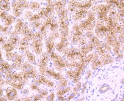 Immunohistochemistry-Paraffin: Dcp1a Antibody (JB51-34) [NBP2-75463] - Analysis of paraffin-embedded human liver tissue using anti-Dcp1a antibody. Counter stained with hematoxylin.