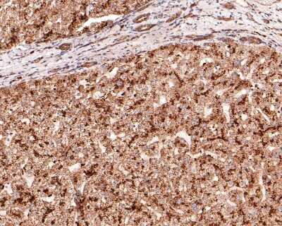 Immunohistochemistry-Paraffin: Dcp1a Antibody (JB51-34) [NBP2-75463] - Analysis of paraffin-embedded human liver tissue with Rabbit anti-Dcp1a antibody washed with ddH2O and PBS, and then probed with the primary antibody  at 1/400 dilution for 1 hour at room temperature. The detection was performed using an HRP conjugated compact polymer system. DAB was used as the chromogen. Tissues were counterstained with hematoxylin and mounted with DPX.