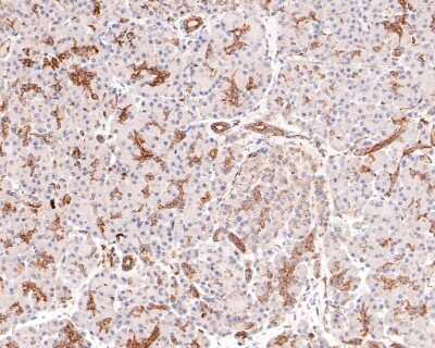 Immunohistochemistry-Paraffin: Dcp1a Antibody (JB51-34) [NBP2-75463] - Analysis of paraffin-embedded human pancreas tissue with Rabbit anti-Dcp1a antibody washed with ddH2O and PBS, and then probed with the primary antibody  at 1/400 dilution for 1 hour at room temperature. The detection was performed using an HRP conjugated compact polymer system. DAB was used as the chromogen. Tissues were counterstained with hematoxylin and mounted with DPX.