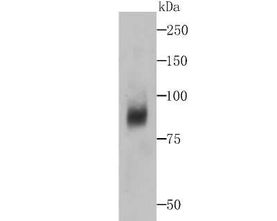 Western Blot: Dcp1a Antibody (JB51-34) [NBP2-75463] - Analysis of Dcp1a on human liver tissue lysates using anti-Dcp1a antibody at 1/500 dilution.