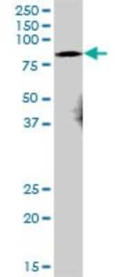 Western Blot: Dcp1a Antibody [H00055802-B01P] - Analysis of DCP1A expression in rat brain.