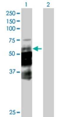 Western Blot: Dcp1a Antibody [H00055802-B01P] - Analysis of DCP1A expression in transfected 293T cell line by DCP1A polyclonal antibody.  Lane 1: DCP1A transfected lysate(64.02 KDa). Lane 2: Non-transfected lysate.