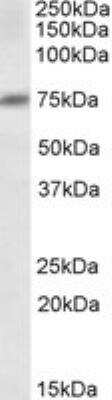 Western Blot: Dcp1a Antibody [NB100-2830] - Staining of lysate of cell line A431 (35 ug protein in RIPA buffer). Antibody at 1 ug/mL. Detected by chemiluminescence.