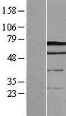 Western Blot: Dcp1a Overexpression Lysate (Adult Normal) [NBL1-09745] Left-Empty vector transfected control cell lysate (HEK293 cell lysate); Right -Over-expression Lysate for Dcp1a.