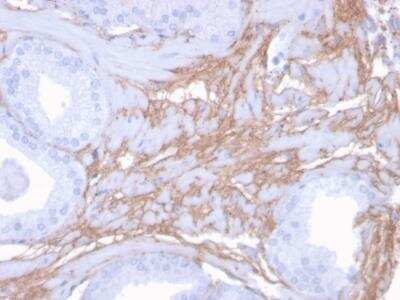 Immunohistochemistry-Paraffin: Decorin Antibody (DCN/3523) - Azide and BSA Free [NBP2-79908] - Formalin-fixed, paraffin-embedded human Prostate stained with Decorin Mouse Monoclonal Antibody (DCN/3523).