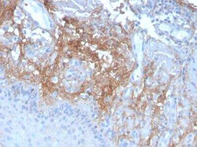 Immunohistochemistry-Paraffin: Decorin Antibody (DCN/3523) - Azide and BSA Free [NBP2-79908] - Formalin-fixed, paraffin-embedded human Skin stained with Decorin Mouse Monoclonal Antibody (DCN/3523).