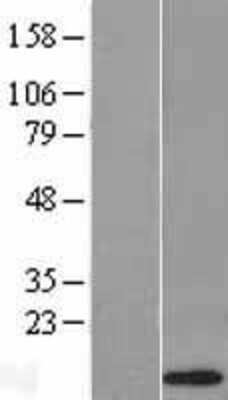 Western Blot: alpha-Defensin 1 Overexpression Lysate [NBL1-09818] -  Left-Empty vector transfected control cell lysate (HEK293 cell lysate); Right -Over-expression Lysate for Defensin alpha 1.