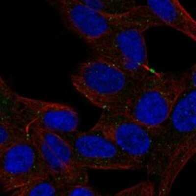 Immunocytochemistry/Immunofluorescence: Defensin alpha 5 Antibody [NBP3-17669] - Staining of human cell line SH-SY5Y shows localization to midbody & vesicles.