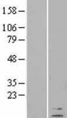 Western Blot: Defensin beta 1 Overexpression Lysate (Adult Normal) [NBL1-09822] Left-Empty vector transfected control cell lysate (HEK293 cell lysate); Right -Over-expression Lysate for Defensin beta 1.