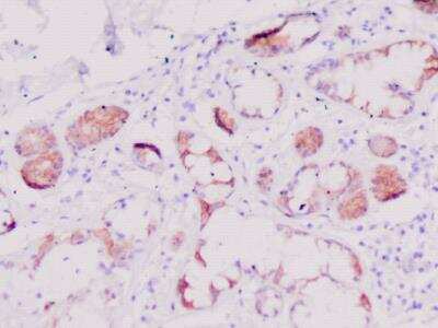 Immunohistochemistry-Paraffin Defensin beta 2 Antibody