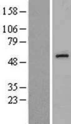 Western Blot: Del-1 Overexpression Lysate (Adult Normal) [NBL1-10112] Left-Empty vector transfected control cell lysate (HEK293 cell lysate); Right -Over-expression Lysate for Del-1.