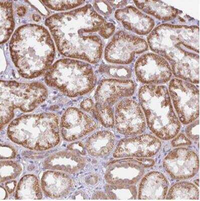 Immunohistochemistry-Paraffin Deleted In Lymphocytic Leukemia, 7 Antibody - BSA Free