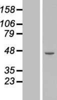 Western Blot Deleted in azoospermia 4 Overexpression Lysate