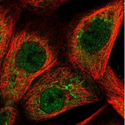 Immunocytochemistry/Immunofluorescence: Delta 1 Tubulin Antibody [NBP1-87391] - Staining  of human cell line A-431 shows positivity in nucleus but not nucleoli, cytoplasm and golgi apparatus. Antibody staining is shown in green.