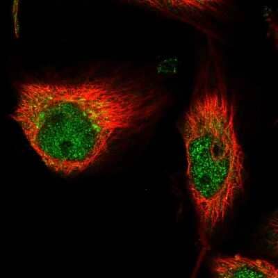 Immunocytochemistry/Immunofluorescence: Delta 1 Tubulin Antibody [NBP1-87391] - Immunofluorescent staining of human cell line U-251 MG shows localization to nucleoplasm & cytosol.