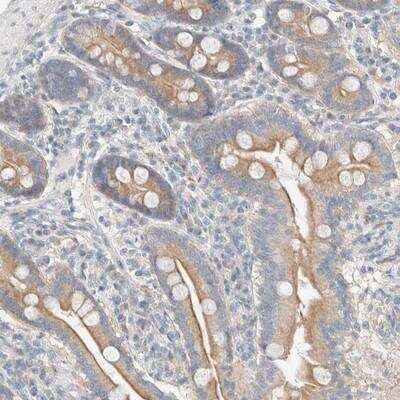 Immunohistochemistry: Delta 1 Tubulin Antibody [NBP1-87391] - Staining of human duodenum shows moderate membranous and cytoplasmic positivity in glandular cells.