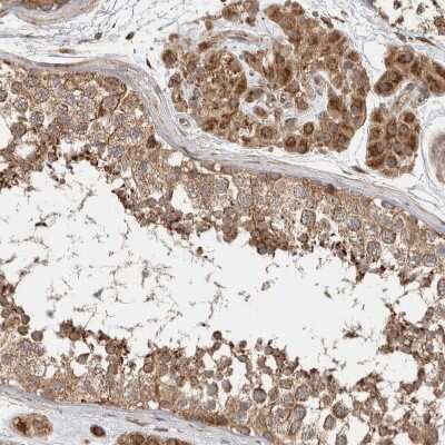 Immunohistochemistry-Paraffin: Delta 1 Tubulin Antibody [NBP1-87390] - Staining of human testis shows strong cytoplasmic positivity in Leydig cells and cells in seminiferous ducts.