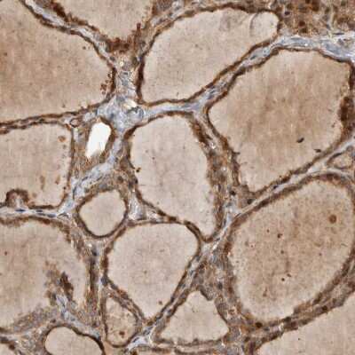 Immunohistochemistry-Paraffin: Delta 1 Tubulin Antibody [NBP1-87390] - Staining of human thyroid gland shows strong cytoplasmic positivity in glandular cells.