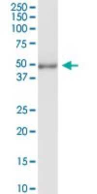 Western Blot: Delta 1 Tubulin Antibody [H00051174-D01P] - Analysis of TUBD1 expression in human placenta.