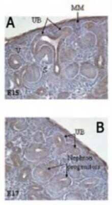 Immunohistochemistry: Delta Np73 Antibody (38C674.2) - Azide Free [NBP2-33262] - Delta Np73 Antibody (38C674.2) analysis of Delta Np73 in embryonic day 15 (A) and day 17 (B) E15 rat embryonic kidney at 1:2000. Delta Np73 is expressed in ureteric bud (UB) branches, and metanephrogenic mesenchyme (MM), as well as in cells invading the g