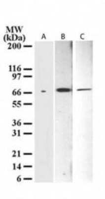 Western Blot: Delta Np73 Antibody (38C674.2) - Azide Free [NBP2-33262] - Delta Np73 Antibody (38C674.2) analysis for Np73 using NBP2-24873 at 1 ug/ml in A) a cell line transfected with Np73 cDNA, B) HeLa, and C) NIH 3T3 cell lysate. Image from the standard format of this antibody.