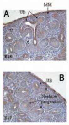 Immunohistochemistry-Frozen: Delta Np73 Antibody (38C674.2) [NBP2-24873] - Delta Np73 Antibody (38C674.2) analysis of Delta Np73 in embryonic day 15 (A) and day 17 (B) E15 rat embryonic kidney at 1:2000. Delta Np73 is expressed in ureteric bud (UB) branches, and metanephrogenic mesenchyme (MM), as well as in cells invading the glomerular cleft. DeltaNp73 is expressed in the ureteric bud (UB) branches, metanephrogenic mesenchyme (MM), and nephron progenitors.