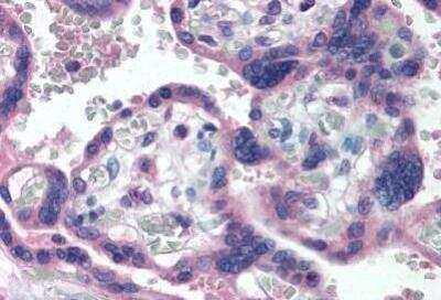 Immunohistochemistry-Paraffin: Delta Np73 Antibody (38C674.2) [NBP2-24873] - Delta Np73 Antibody (38C674.2) Staining of human placenta. Immunohistochemistry of formalin-fixed, paraffin-embedded tissue after heat-induced antigen retrieval. Antibody concentration 5 ug/ml.