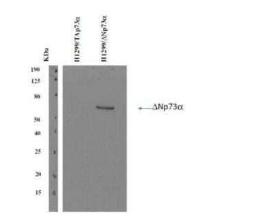 Western Blot: Delta Np73 Antibody (DNp73-1.1) [NBP3-11702] - Analysis of p73 isoforms using mouse monoclonal antibody DNp73-1.1. This antibody is suitable for distinguishing between them. It detected specifically deltaNp73 isoform in H1299/deltaNp73 transfectants, whereas it ignored TAp73 isoform in H1299/TAp73 transfectants. 