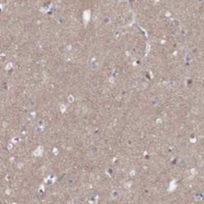 Immunohistochemistry-Paraffin Dematin Antibody - BSA Free