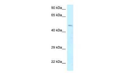 Western Blot: Dematin Antibody [NBP2-84769] - WB Suggested Anti-EPB49 Antibody. Titration: 1.0 ug/ml. Positive Control: Jurkat Whole Cell