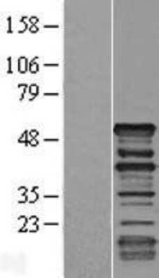 Western Blot Dematin Overexpression Lysate