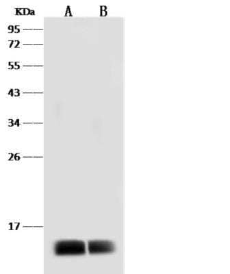 Western Blot: Dengue Virus 2 Envelope Antibody [NBP3-05839] - Sample:Dengue virus (DENV) (type 2, strain New Guinea C/PUO-218 hybrid) E / Envelope Protein (Domain III) Recombinant ProteinLane A: 30ngLane B: 10ngSecondaryHRP Conjugated Goat anti-Rabbit IgG (H+L) at 1/10000 dilutionPerformed under reducing conditions.