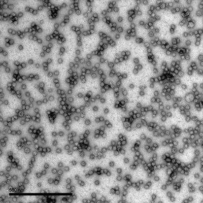 Electron Microscopy: Dengue Virus 2 VLP Recombinant Protein Antigen [NBP3-14813] - Negative staining electron microscopy of DENV2 virus-like particles (VLPs).