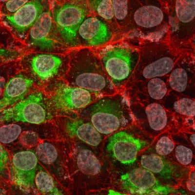 Immunocytochemistry/Immunofluorescence: Dengue Virus 2 premembrane (prM) Envelope Antibody (CC5.A9.E10) [NBP3-14844] - Immunofluorescent staining of Dengue Virus serotype 1 infected cells using Dengue Virus 2 premembrane (prM) Envelope antibody.