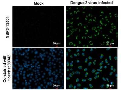 Immunocytochemistry/Immunofluorescence: Dengue Virus NS1 protein Antibody (GT1061) [NBP3-13504] - NS1 (Dengue virus ) antibody [GT1061] detects NS1 (Dengue virus ) protein at cytoplasm by immunofluorescent analysis. Samples: BHK-21 cells mock (left) and infected with Dengue virus 2 (right) were fixed in MeOH. Green: NS1 (Dengue virus ) protein stained by NS1 (Dengue virus ) antibody [GT1061] (NBP3-13504) diluted at 1:2000. Blue: Hoechst 33342 staining.