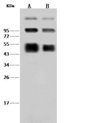 Western Blot: Dengue Virus NS1 protein Antibody [NBP3-06439] - Anti-Dengue virus (DENV) (type 2, strain New Guinea C) NS1 rabbit polyclonal antibody at 1:2000 dilution. Sample:Dengue virus (DENV) (type 2, strain New Guinea C) NS1 Recombinant Protein. Lane A: 30ng Lane B: 10ng. Secondary: Goat Anti-Rabbit IgG (H+L)/HRP at 1/10000 dilution. Developed using the ECL technique. Performed under reducing conditions.