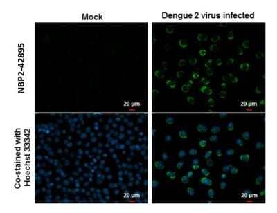 Immunocytochemistry/Immunofluorescence: Dengue Virus NS4B Antibody [NBP2-42895] - Dengue Virus NS4B antibody detects Dengue Virus NS4B protein at cytoplasm by immunofluorescent analysis. Samples: BHK-21 cells mock (left) and infected with Dengue virus 2 (right) were fixed in MeOH. Green: Dengue Virus NS4B protein stained by Dengue Virus NS4B antibody diluted at 1:2000. Blue: Hoechst 33342 staining.