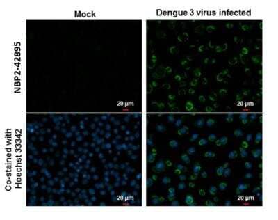 Immunocytochemistry/Immunofluorescence: Dengue Virus NS4B Antibody [NBP2-42895] - Dengue Virus NS4B antibody detects Dengue Virus NS4B protein at cytoplasm by immunofluorescent analysis. Samples: BHK-21 cells mock (left) and infected with Dengue virus 3 (right) were fixed in MeOH. Green: Dengue Virus NS4B protein stained by Dengue Virus NS4B antibody diluted at 1:2000. Blue: Hoechst 33342 staining.