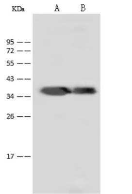 Western Blot: Dengue Virus NS5 Antibody - (methyltransferase domain) [NBP3-06447] - Anti-Dengue virus DENV-2 (strain New Guinea C) NS5 (methyltransferase domain) / Nonstructural protein 5 polyclonal antibody at 1:20000 dilution.Sample: Dengue virus DENV-2 (strain New Guinea C) NS5 (methyltransferase domain) / Nonstructural protein 5 Recombinant Protein. Lane A:5ng Lane B:1ng. Secondary: Goat Anti-Rabbit IgG (H+L)/HRP at 1/10000 dilution.Developed using the ECL technique.Performed under reducing conditions.