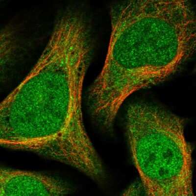 Immunocytochemistry/Immunofluorescence: Deoxycytidylate deaminase Antibody [NBP1-87424] - Immunofluorescent staining of human cell line U-2 OS shows localization to nucleoplasm & cytosol.