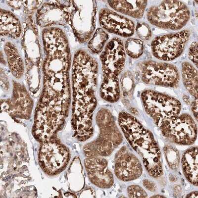 Immunohistochemistry-Paraffin: Deoxycytidylate deaminase Antibody [NBP1-87424] - Staining of human kidney shows strong cytoplasmic positivity in cells in tubules.