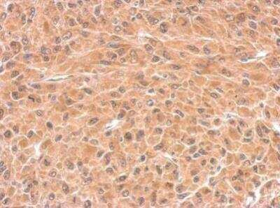 Immunohistochemistry-Paraffin: Deoxycytidylate deaminase Antibody [NBP2-16149] -  Paraffin-embedded U87 xenograft. DCTD antibody  dilution: 1:500.