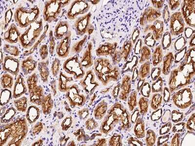 Immunohistochemistry-Paraffin: Deoxycytidylate deaminase Antibody [NBP2-99193] - Immunochemical staining Deoxycytidylate deaminase in human kidney with rabbit polyclonal antibody at 1:1000 dilution, formalin-fixed paraffin embedded sections.