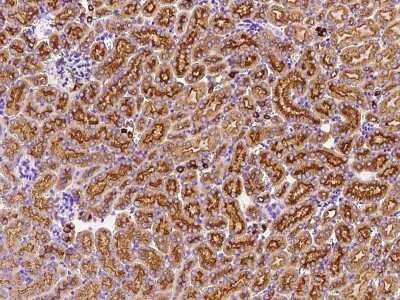 Immunohistochemistry-Paraffin: Deoxycytidylate deaminase Antibody [NBP2-99193] - Immunochemical staining Deoxycytidylate deaminase in mouse kidney with rabbit polyclonal antibody at 1:1000 dilution, formalin-fixed paraffin embedded sections.